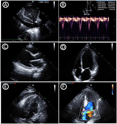 Visual Rounds Based on Multiorgan Point-of-Care Ultrasound in the ICU